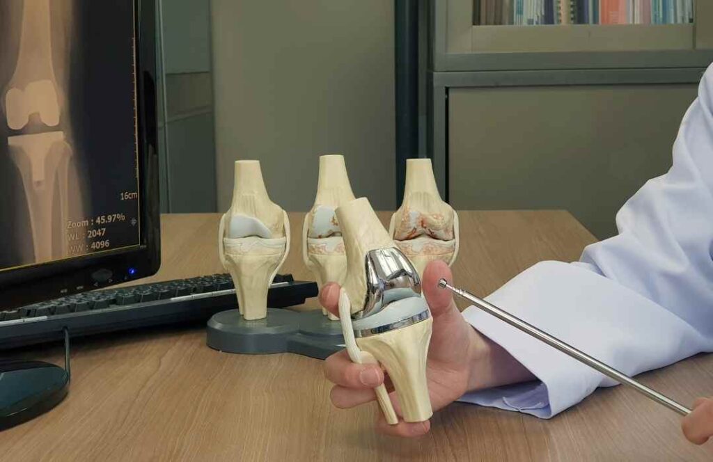 Knee Replacement Surgery – What Patients Should Expect – Dr Ramkinkar Jha